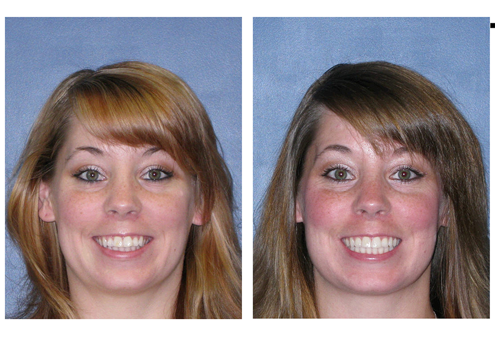 Bright Smile Dental Care