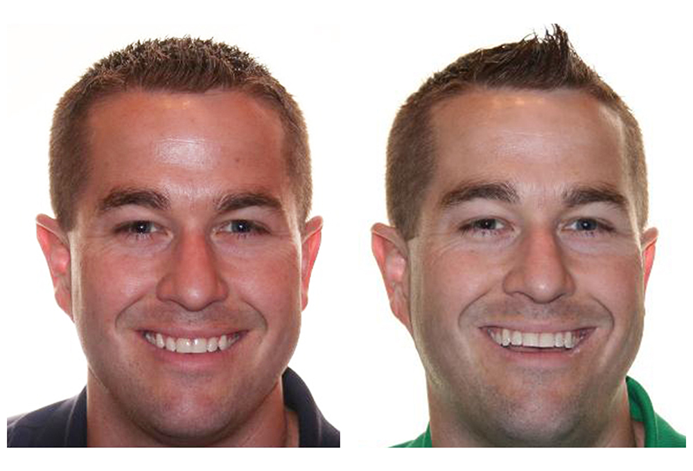 Bright Smile Dental Care