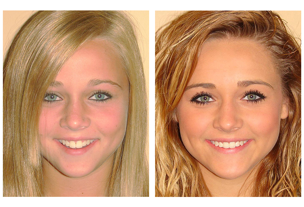 Bright Smile Dental Care