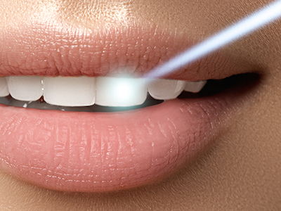 Bright Smile Dental Care, LTD | Inlays  amp  Onlays, TMJ Disorders and Root Canals
